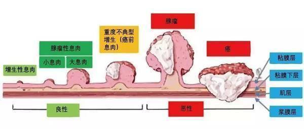 带薪拉屎！机构招粪便捐献员：最高月入六千 用于肠道疾病治疗